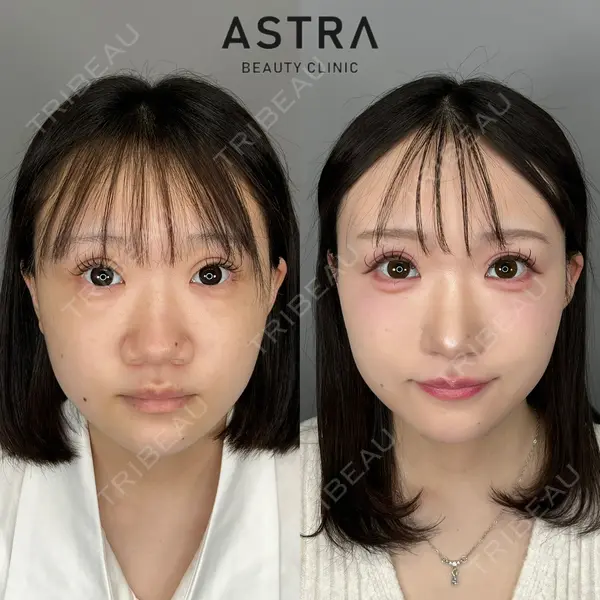 ASTRA BEAUTY CLINIC 塩満 惠子医師の症例
