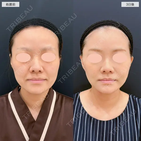 A CLINIC（エークリニック） 仙台院 伊藤 瑠桂医師の症例