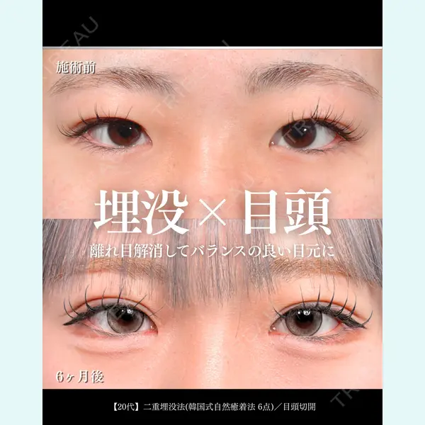 東京シンデレラ美容外科 大宮院 竹田 昌平医師の症例