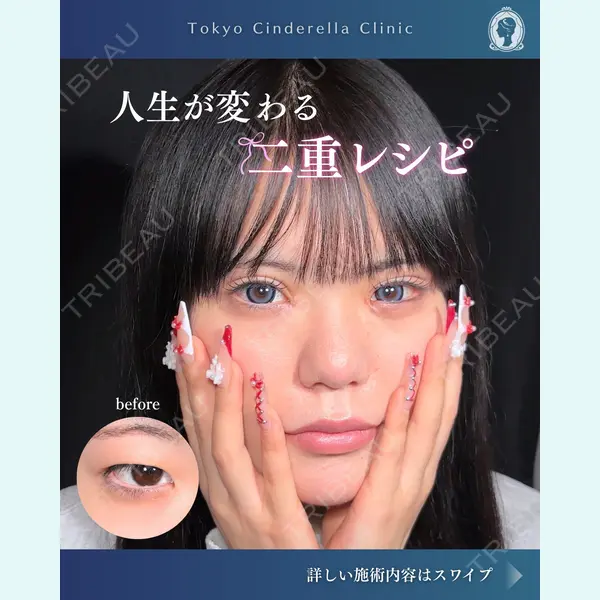 東京シンデレラ美容外科  横浜院 吉田 利之医師の症例