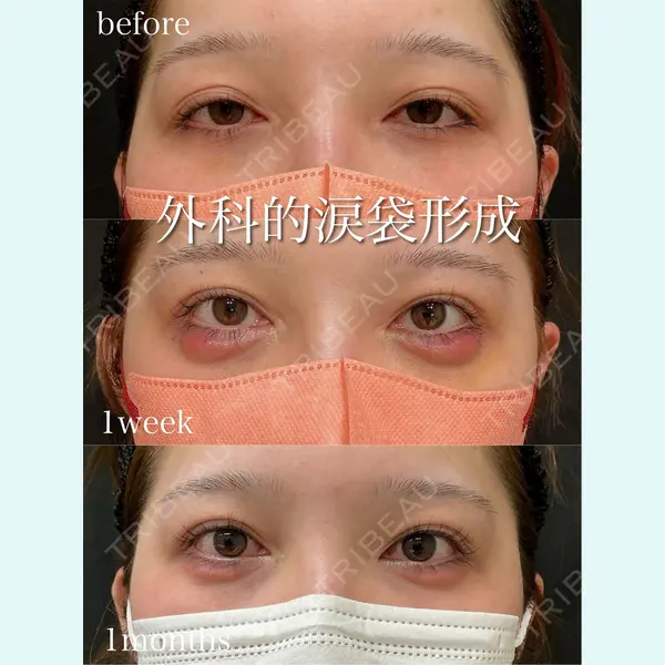 アデル美容クリニックの症例