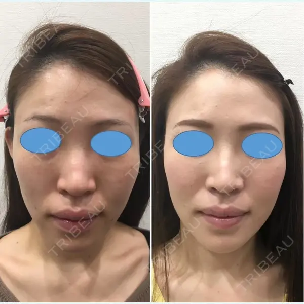 しのぶ皮膚科 蘇原しのぶ医師の症例