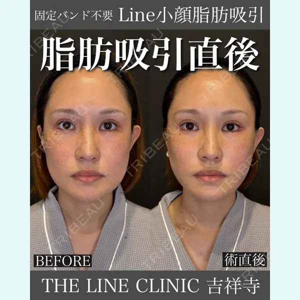 THE LINE CLINIC KICHIJOJI 三橋 克之医師の症例