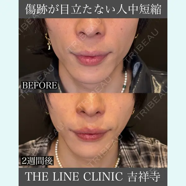 THE LINE CLINIC KICHIJOJI 三橋 克之医師の症例