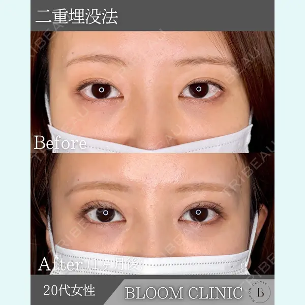 ブルームクリニック（BLOOM CLINIC）の症例