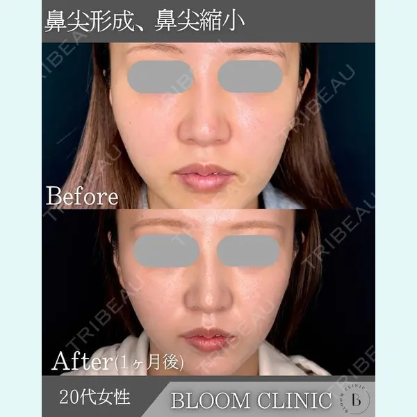 ブルームクリニック（BLOOM CLINIC）の症例