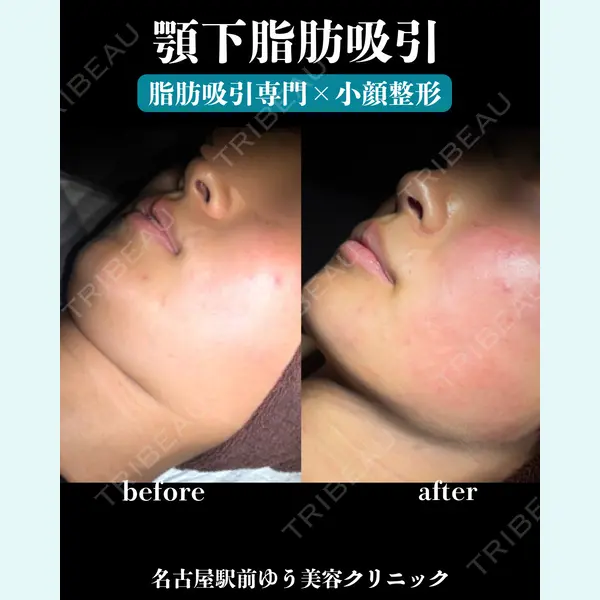 名古屋駅前ゆう美容クリニック 伊藤 優医師の症例