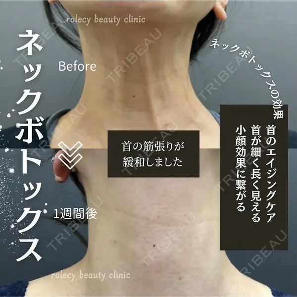 ロレシー美容クリニック 心斎橋駅前院 福留院長医師の症例