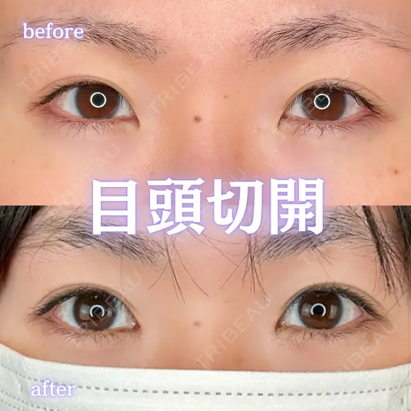 ルラ美容クリニック 新宿院 陶 美梨医師の症例