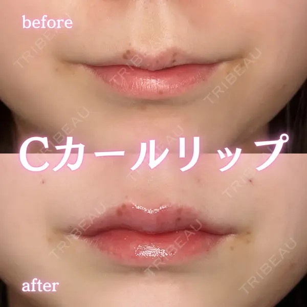 ルラ美容クリニック 新宿院 陶 美梨医師の症例