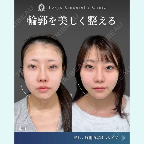東京シンデレラ美容外科  横浜院 吉田 利之医師の症例