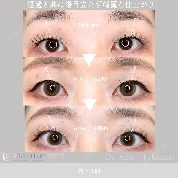PRO CLINIC プロクリニック 銀座院 洪 嵩典医師の症例