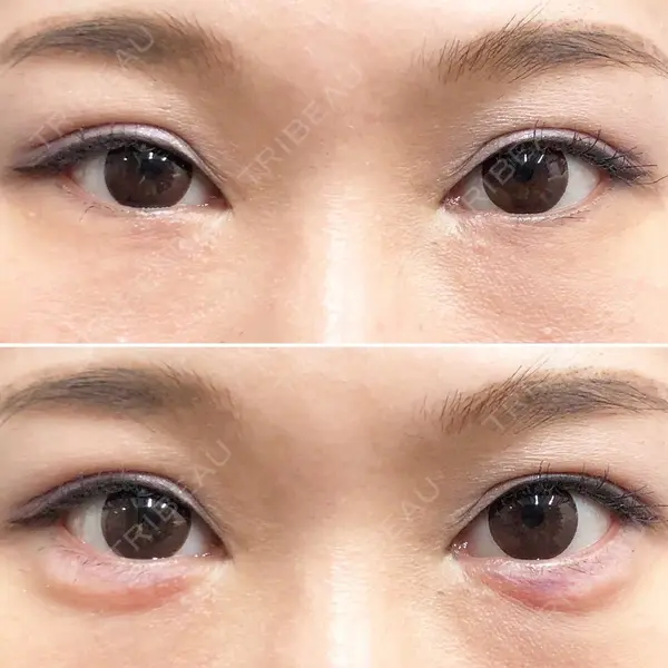 しのぶ皮膚科 蘇原しのぶ医師の症例