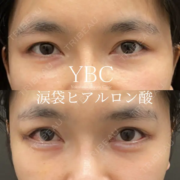 YBC横浜美容外科 池袋院 磯村 亮輔医師の症例