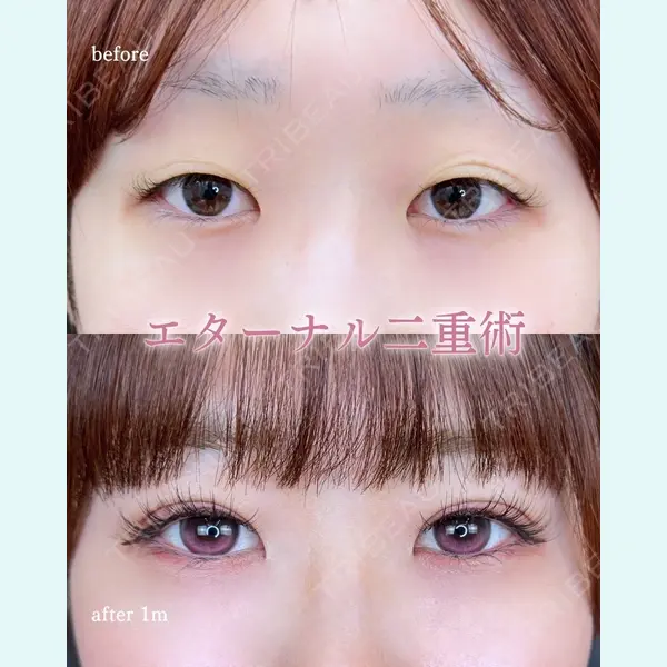 ルラ美容クリニック 町田院 松岡 舟作医師の症例