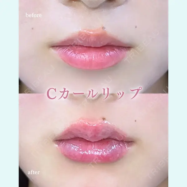 ルラ美容クリニック 町田院 松岡 舟作医師の症例