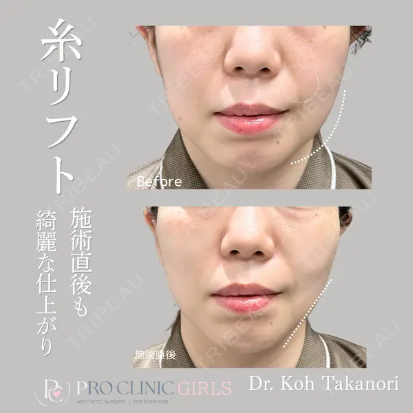 PRO CLINIC プロクリニック 銀座院 洪 嵩典医師の症例