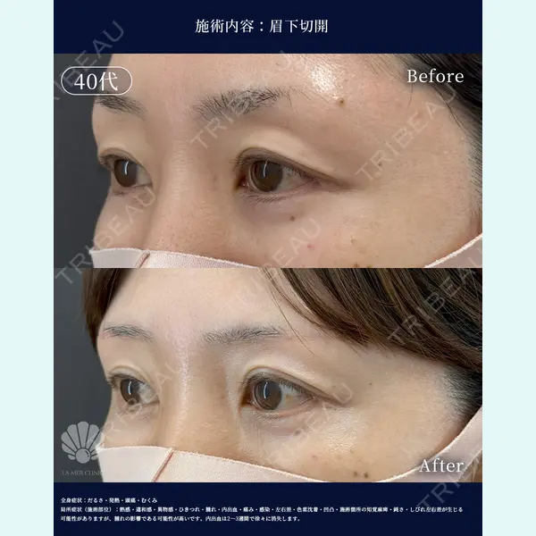 LA MER CLINIC 辻 航平医師の症例