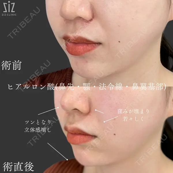 ziz CLINIC 村岡 史子医師の症例