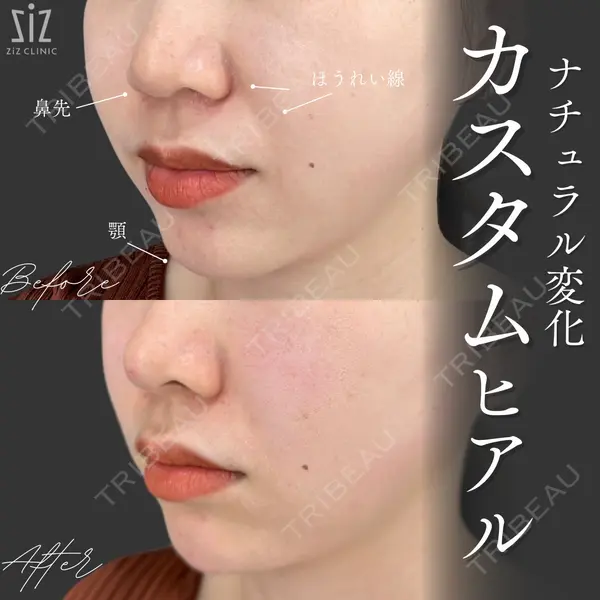 ziz CLINIC 村岡 史子医師の症例