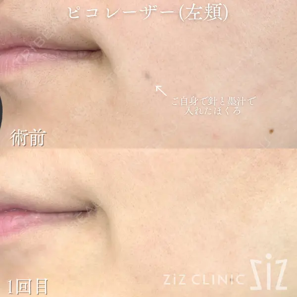 ziz CLINIC 村岡 史子医師の症例