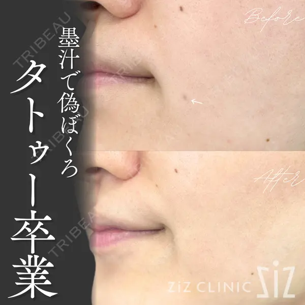 ziz CLINIC 村岡 史子医師の症例