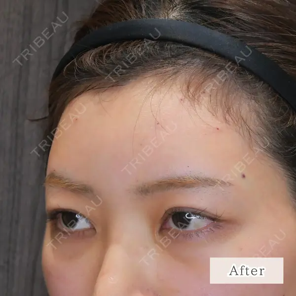 CLEAN BEAUTY CLINIC TokyoAzabu 三田 亜耶医師の症例