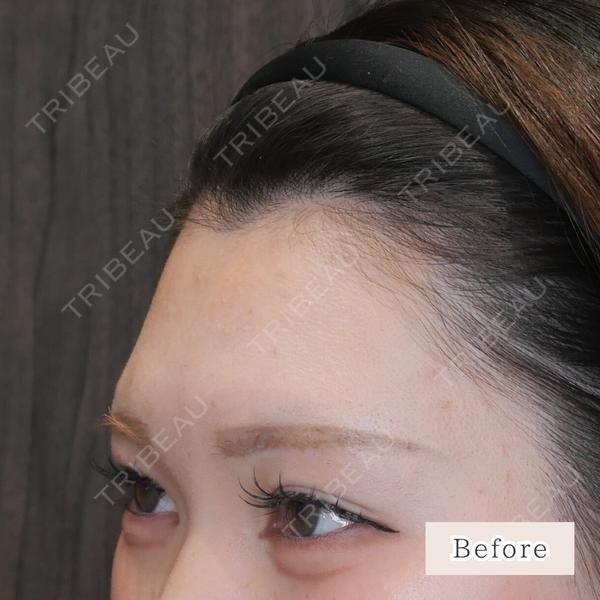 CLEAN BEAUTY CLINIC TokyoAzabu 三田 亜耶医師の症例