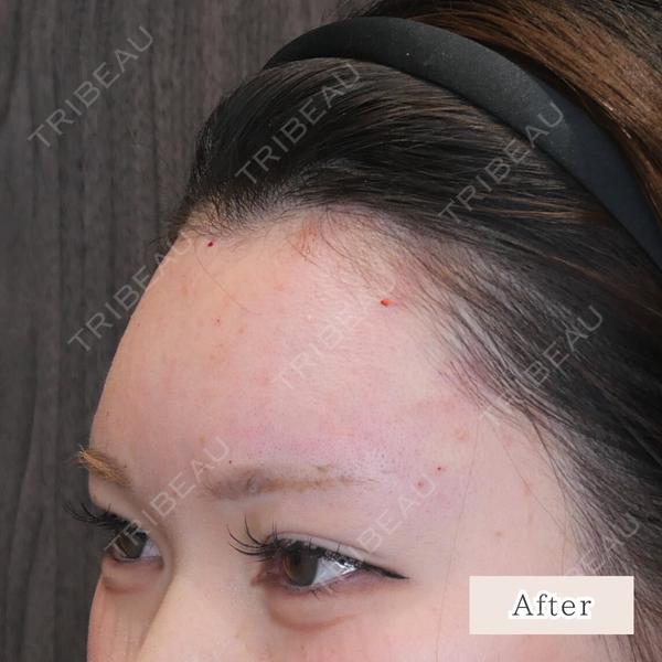 CLEAN BEAUTY CLINIC TokyoAzabu 三田 亜耶医師の症例