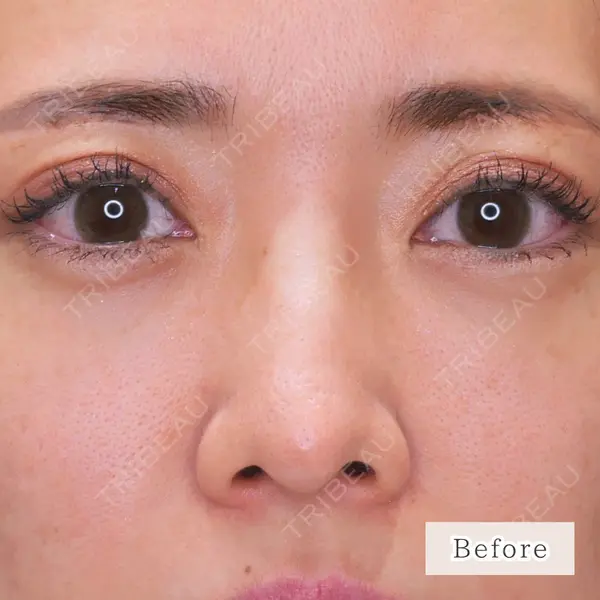 CLEAN BEAUTY CLINIC TokyoAzabu 三田 亜耶医師の症例