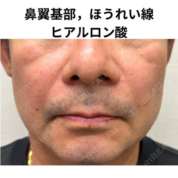 おおたかの森ビューティークリニック 海野 芙美香医師の症例