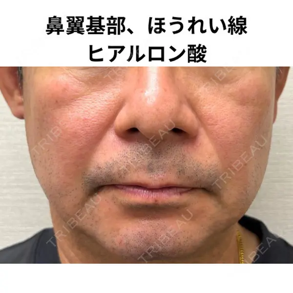 おおたかの森ビューティークリニック 海野 芙美香医師の症例