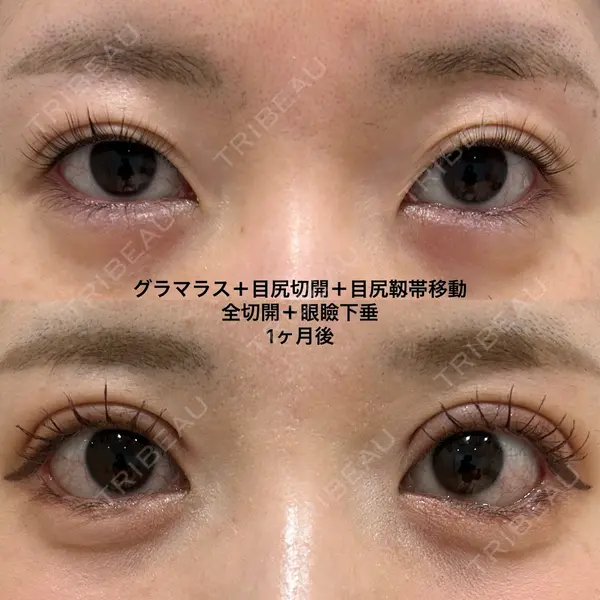 エターナル美容クリニック 久門田 詳医師の症例