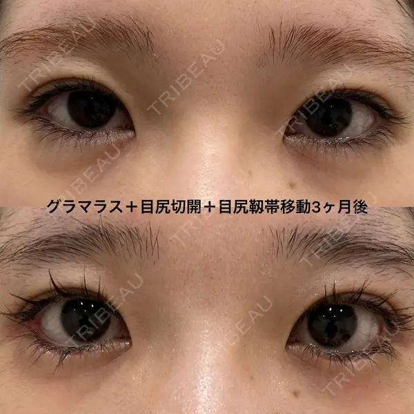 エターナル美容クリニック 久門田 詳医師の症例