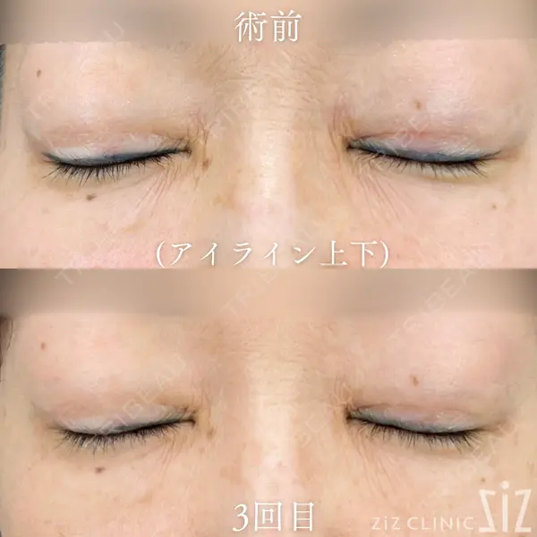 ziz CLINIC 村岡 史子医師の症例