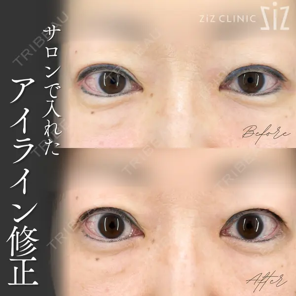 ziz CLINIC 村岡 史子医師の症例