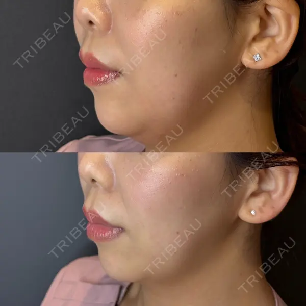 EME CLINIC 井上 裕章医師の症例