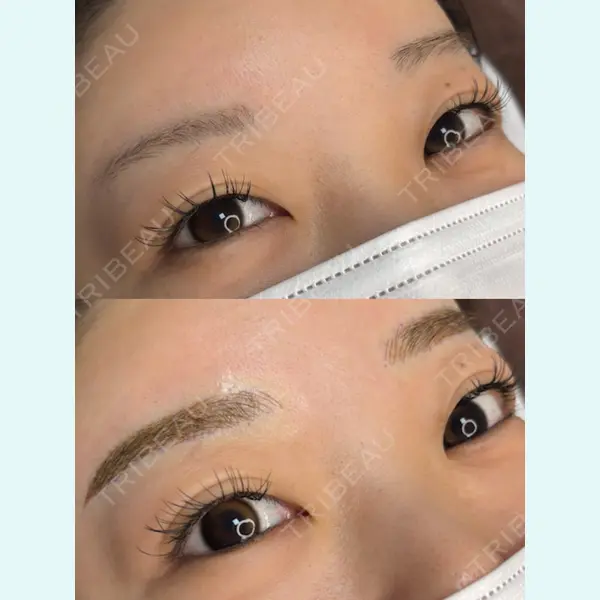 EME CLINIC 井上 裕章医師の症例