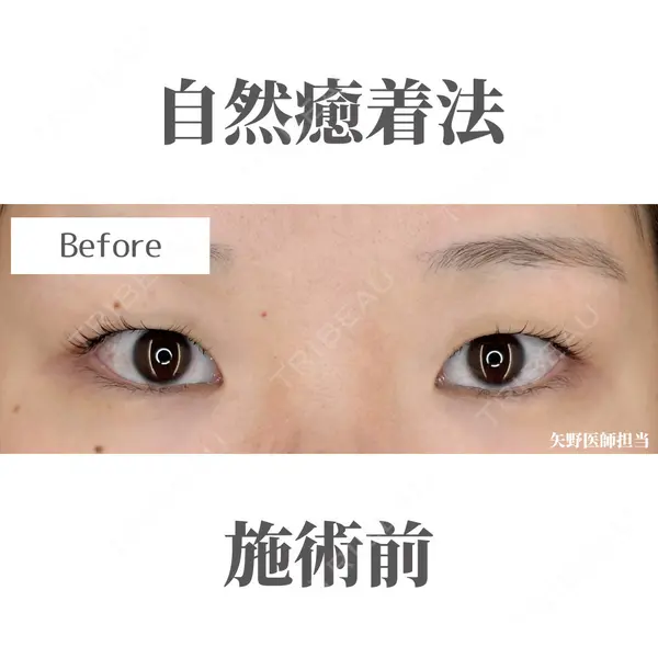 Belle Via Clinicの症例