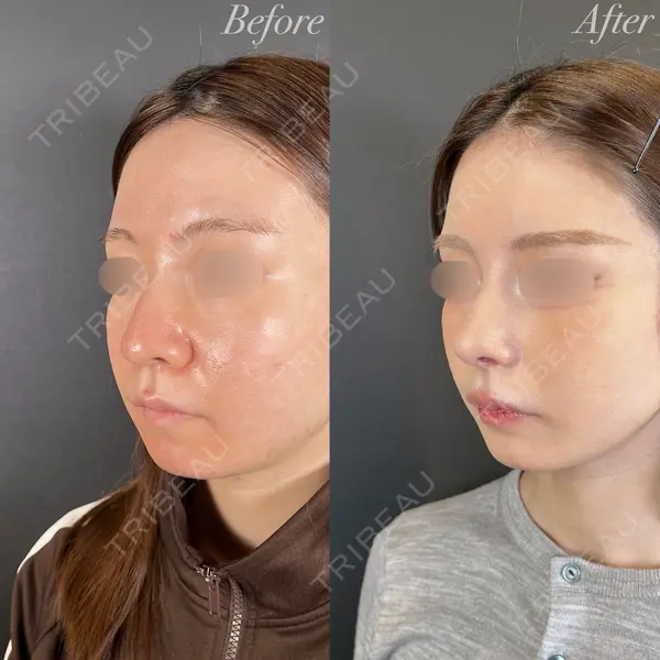R Beauty CLINIC 大阪院 小池 泰弘医師の症例