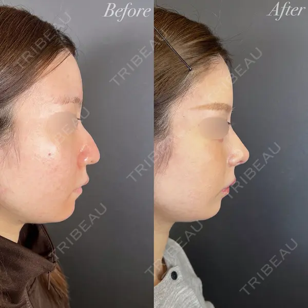 R Beauty CLINIC 大阪院 小池 泰弘医師の症例
