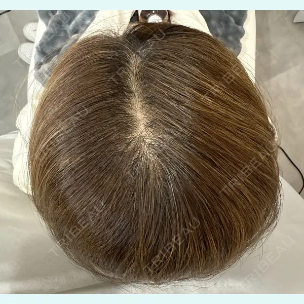 One Hair Artmake(One Beauty Clinic) 大塚 みさ医師の症例