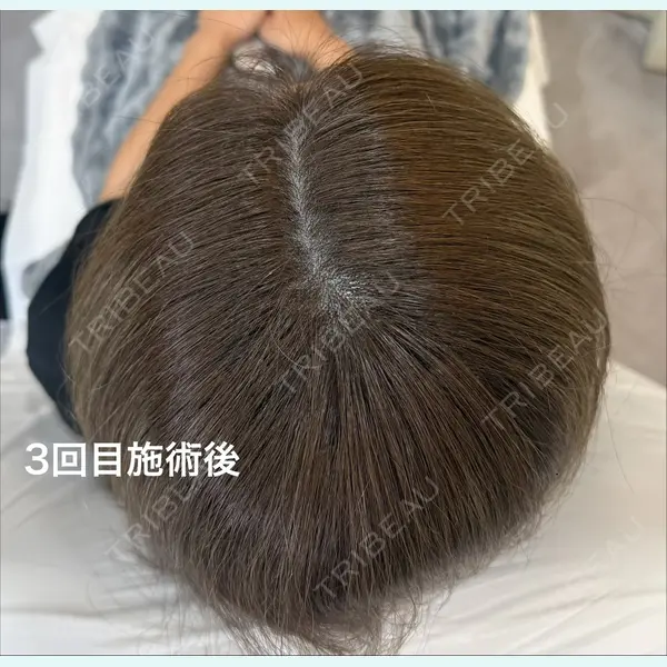 One Hair Artmake(One Beauty Clinic) 大塚 みさ医師の症例