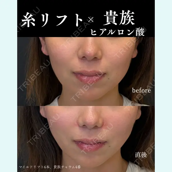 銀座美容クリニック 南草津院 廣瀨 昇吾医師の症例