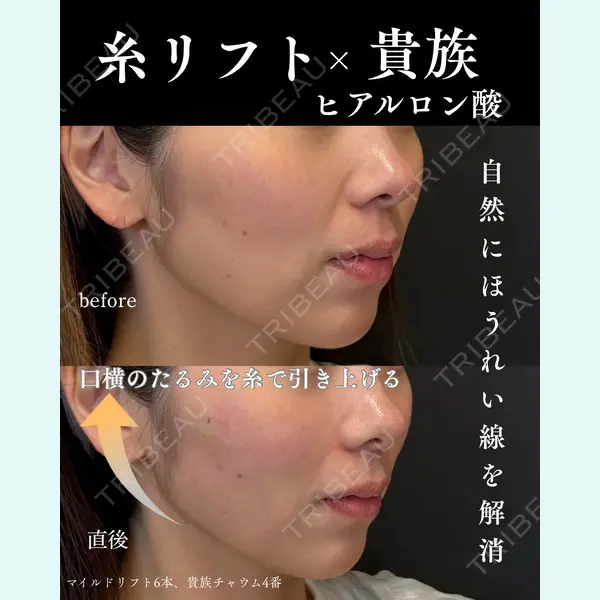 銀座美容クリニック 南草津院 廣瀨 昇吾医師の症例