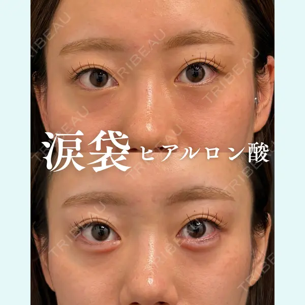 銀座美容クリニック 南草津院 廣瀨 昇吾医師の症例