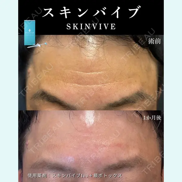 銀座美容クリニック 南草津院 廣瀨 昇吾医師の症例