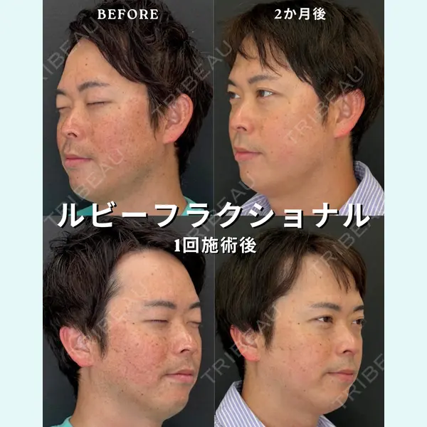 銀座美容クリニック 南草津院 廣瀨 昇吾医師の症例