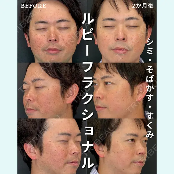 銀座美容クリニック 南草津院 廣瀨 昇吾医師の症例