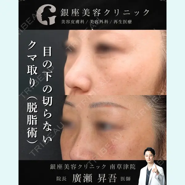 銀座美容クリニック 南草津院 廣瀨 昇吾医師の症例